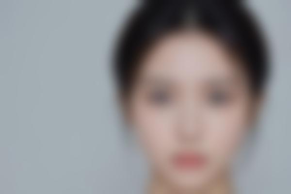石家庄何晓娅鼻修复技术强吗？何晓娅医生做鼻子2万元起真实对比超惊艳！