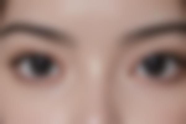 4、医疗严格