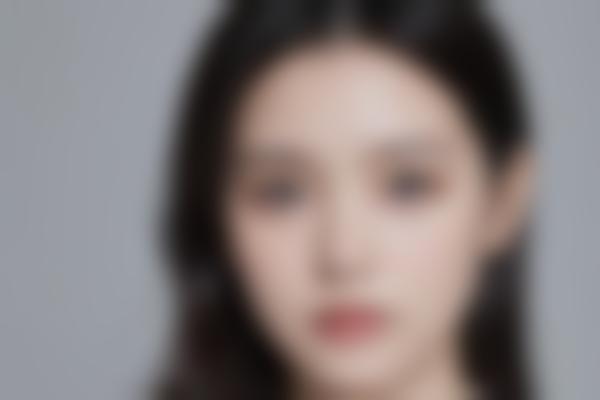 北京冯斌医生脂肪修复技术出众，冯斌馒化脸修复价格3万起重塑精致轮廓！