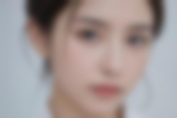 武汉医院曹玮医生眼整形与修复实力解析，20年临床经验打造自然美