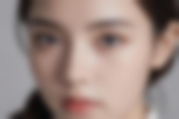 太原华晋医院郭霞医生整形技术,眼部鼻部唇部综合整形自然