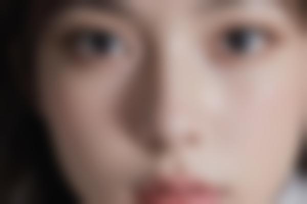 3、向艺鼻修复手术有