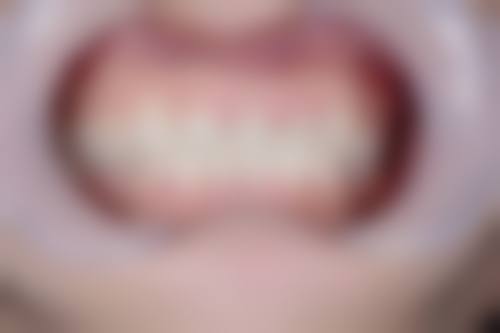 四、宜昌铂莱美口腔门诊特色项目