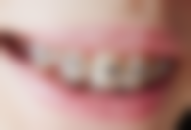 六、广州正和口腔门诊部口碑如何？