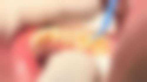 六、宁阳华诺口腔口碑如何？