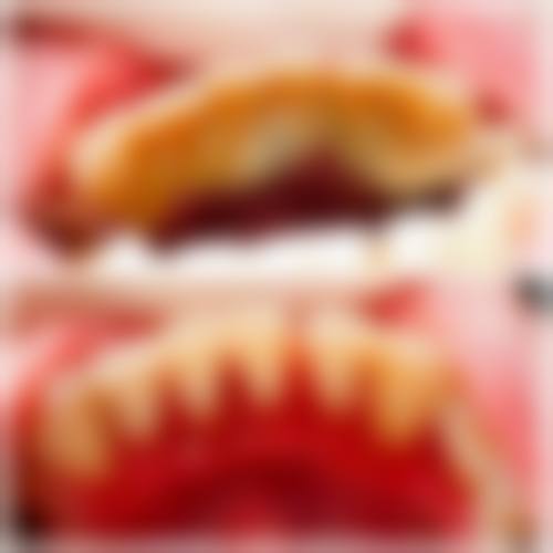 四、诸城宇宸口腔特色项目