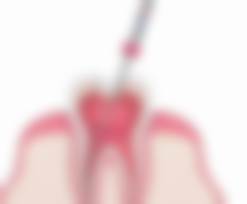 四、福州美可普口腔门诊部(五一分院)特色项目