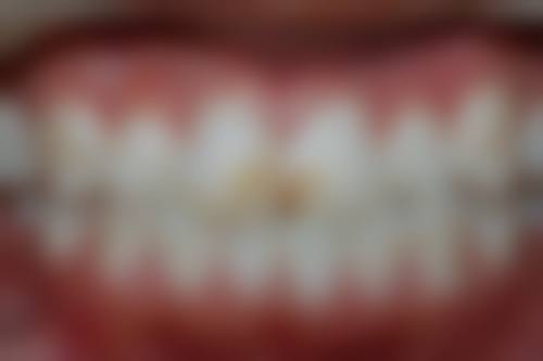 如何确保安心备孕