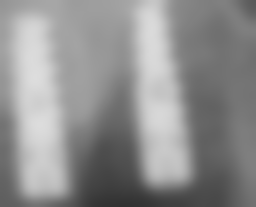 六、河北保定容城永刚口腔口碑如何？