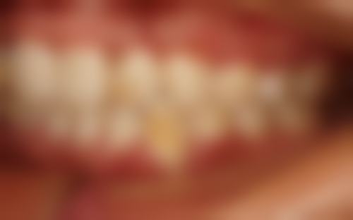 四、肇庆张伟新朱建珍医生坐诊医院