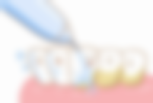 四、河北保定容城永刚口腔特色项目