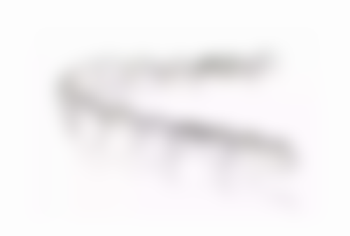 补牙之后还痛正常吗？短时间术后反应属正常，但这些异常疼痛情况需及时就医！ 