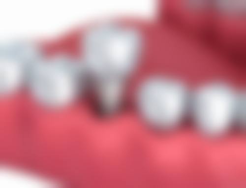 五、湖南省怀化市赖尔口腔门诊有限公司人民路分公司收费价格表