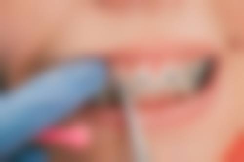 六、云南昆明寻甸博美口腔口碑如何?