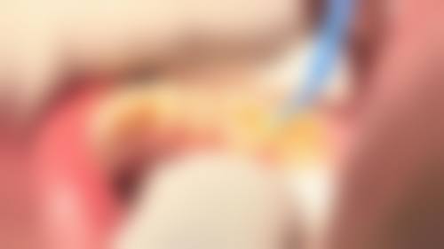 七、云南昆明寻甸博美口腔地址电话及营业时间