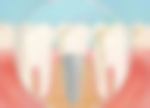 八、无锡惠山罗宇口腔诊所怎么预约?