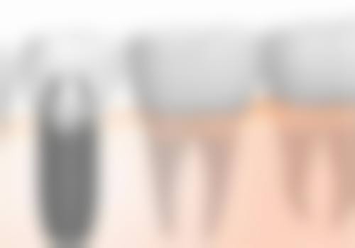 五、山东泰安牙悦口腔门诊部收费价格表