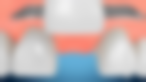 舒适感受：种植牙减少口腔异物感