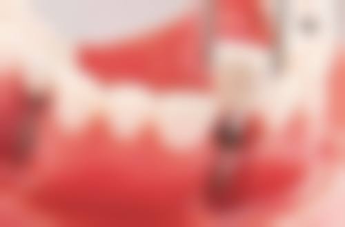 四、江苏无锡宏武口腔特色项目