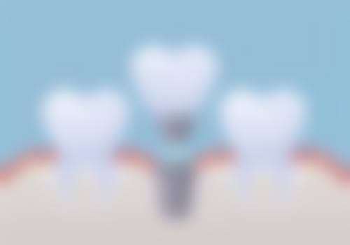 八、江西宜春樟树世代口腔怎么预约？