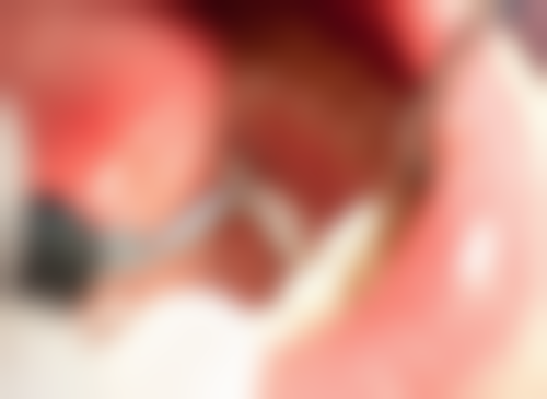 四、长沙天心文飞口腔诊所特色项目