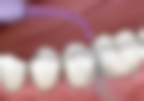 五、深圳永乐口腔诊所收费价格表