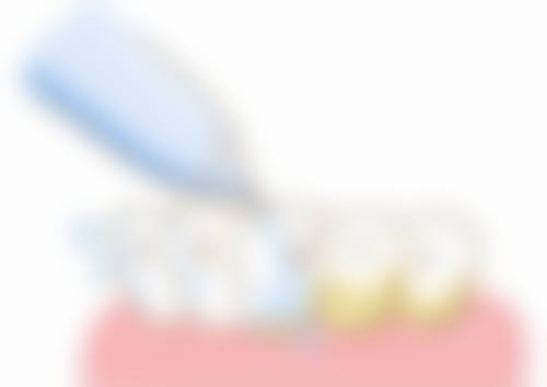 四、焦作植得口腔(解放路)特色项目