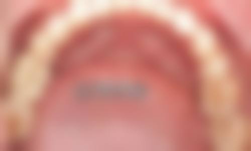 八、广东深圳华霆口腔怎么预约?