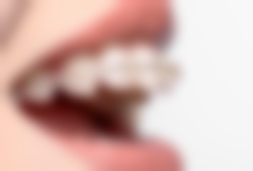 血压高可以拔牙齿吗？这取决于血压控制情况，稳定时可拔，高值时拔牙有风险！ 