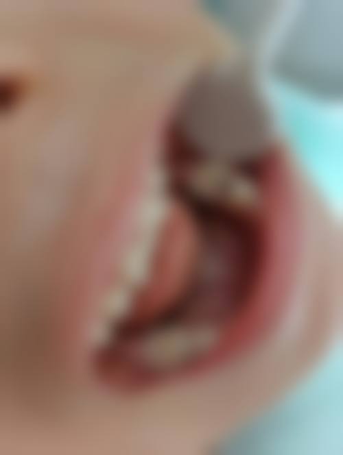 八、江西省鹰潭市汪国斌牙科怎么预约？