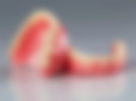 拔牙过程中的注意事项