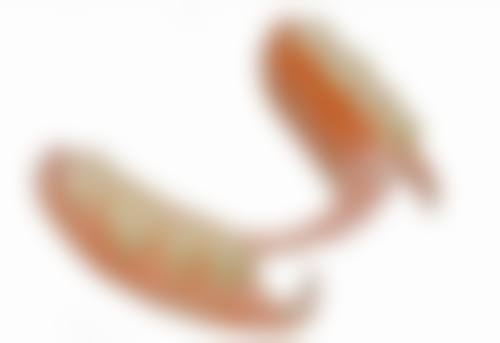 哪种方式牙齿矫正好？需结合年龄、牙齿问题、美观需求等，不同情况有不同优选方式！ 