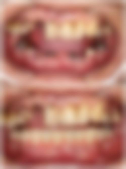 八、江苏淮安雅美口腔怎么预约？