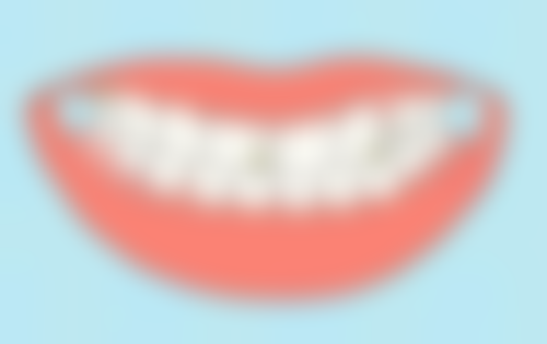 适合80岁以上老人的多样补牙方式