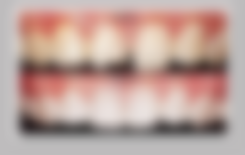 拔牙以后不种牙可以吗？关注口腔整体情况