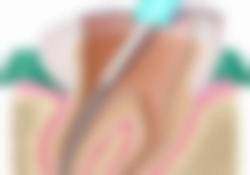 四、莆田匠心口腔门诊部特色项目