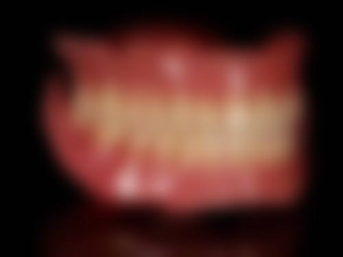 六、东莞瑞华口腔李小刚医生口碑评价及真人实例反馈