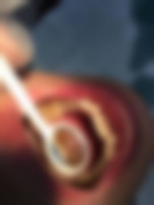 八、山东临沂姚翠云口腔诊所怎么预约？