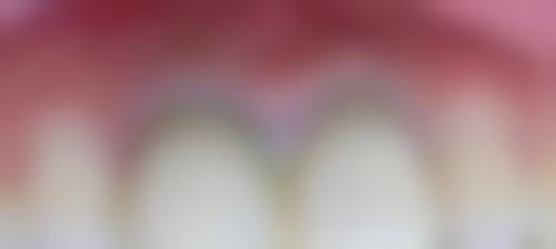 五、江苏扬州新森医院口腔科收费价格表