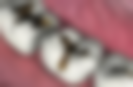 韩国登腾种植牙怎么识别真假？可从扫码、看标签、查资质等多方面入手，轻松辨真伪！ 