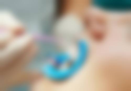 种植牙瑞士和韩国哪个好？从多维度对比，高端求稳选瑞士，性价比高则选韩国！ 