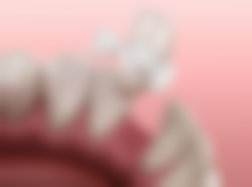 拔牙前后如何配合减轻疼痛