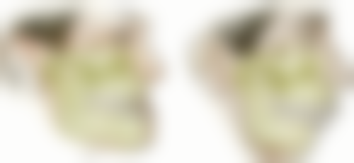 孩子的牙齿矫正到底好不好？好处有改善咀嚼等六点，弊端含不适等四点需综合考量！ 