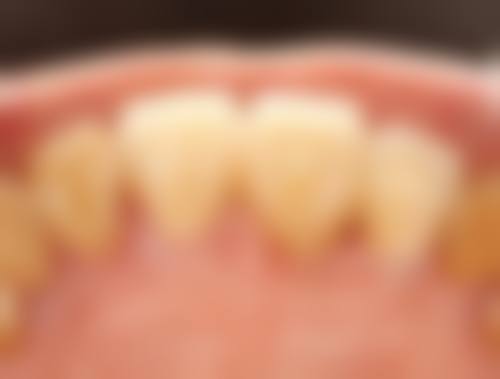 五、湖州安吉佳源口腔收费价格表