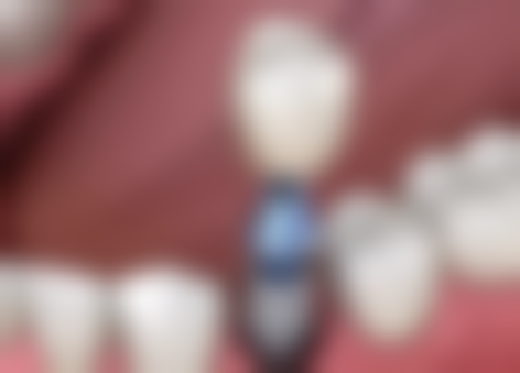 五、湖州微微口腔诊所收费价格表