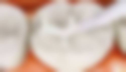 八、北京西尔口腔（柳芳分院）怎么预约？