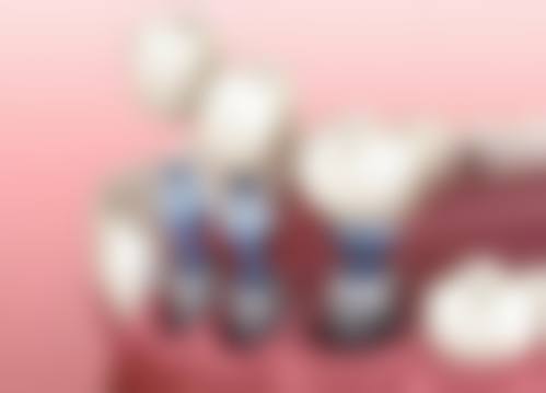 五、福州奇志星成口腔收费价格表