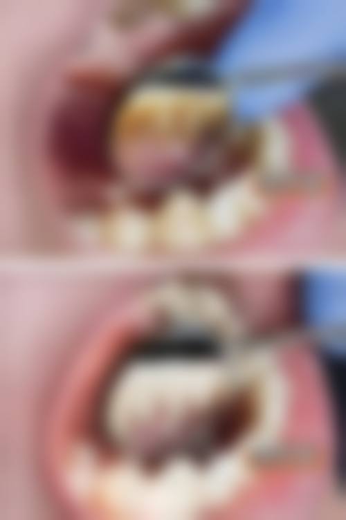 六、北京西尔口腔（柳芳分院）口碑如何？