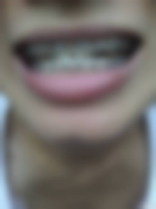 五、德州致美口腔诊所(十中店)收费价格表