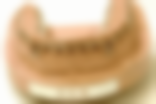 地包天如果不纠正有影响吗？影响心理健康